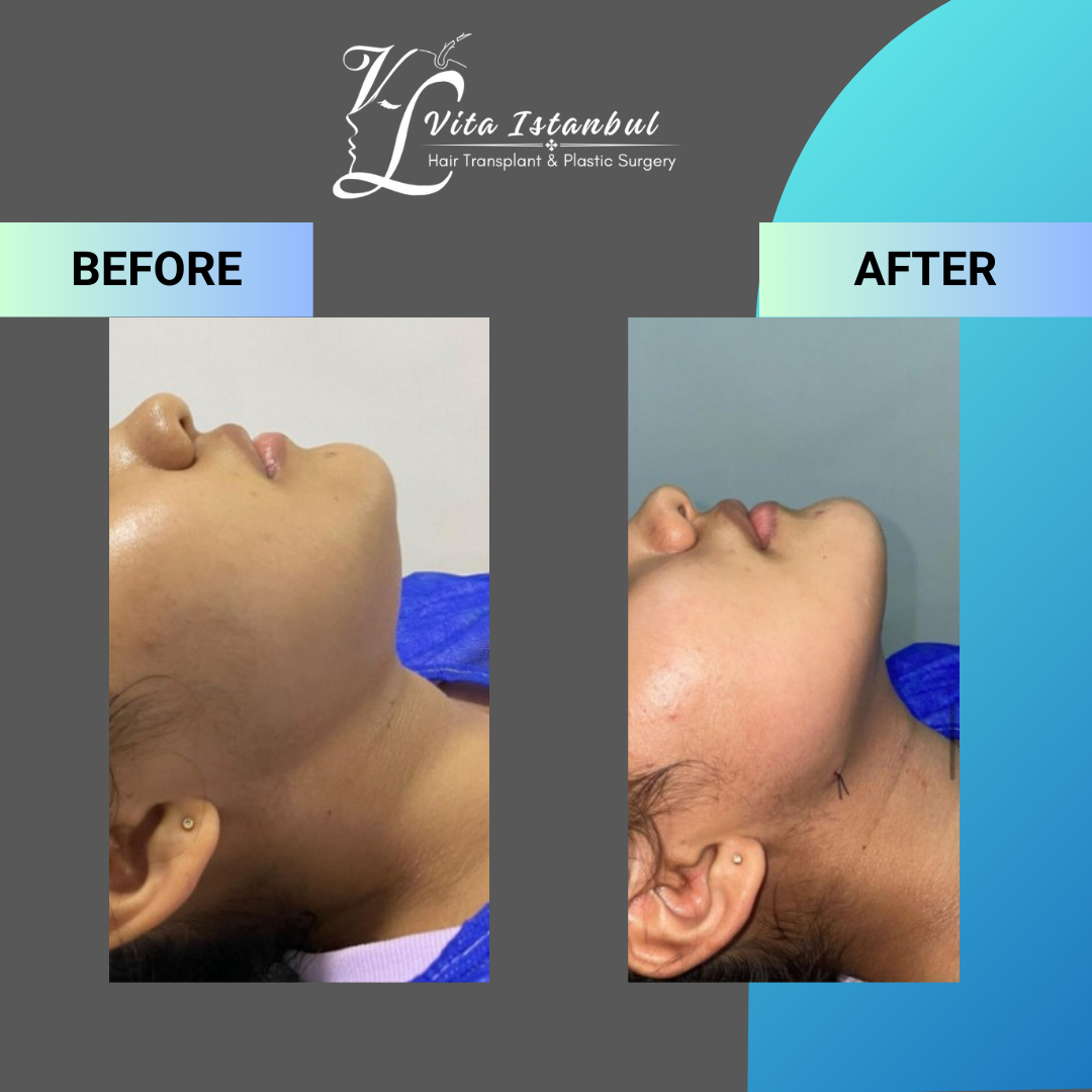 Facial Plastic Surgery