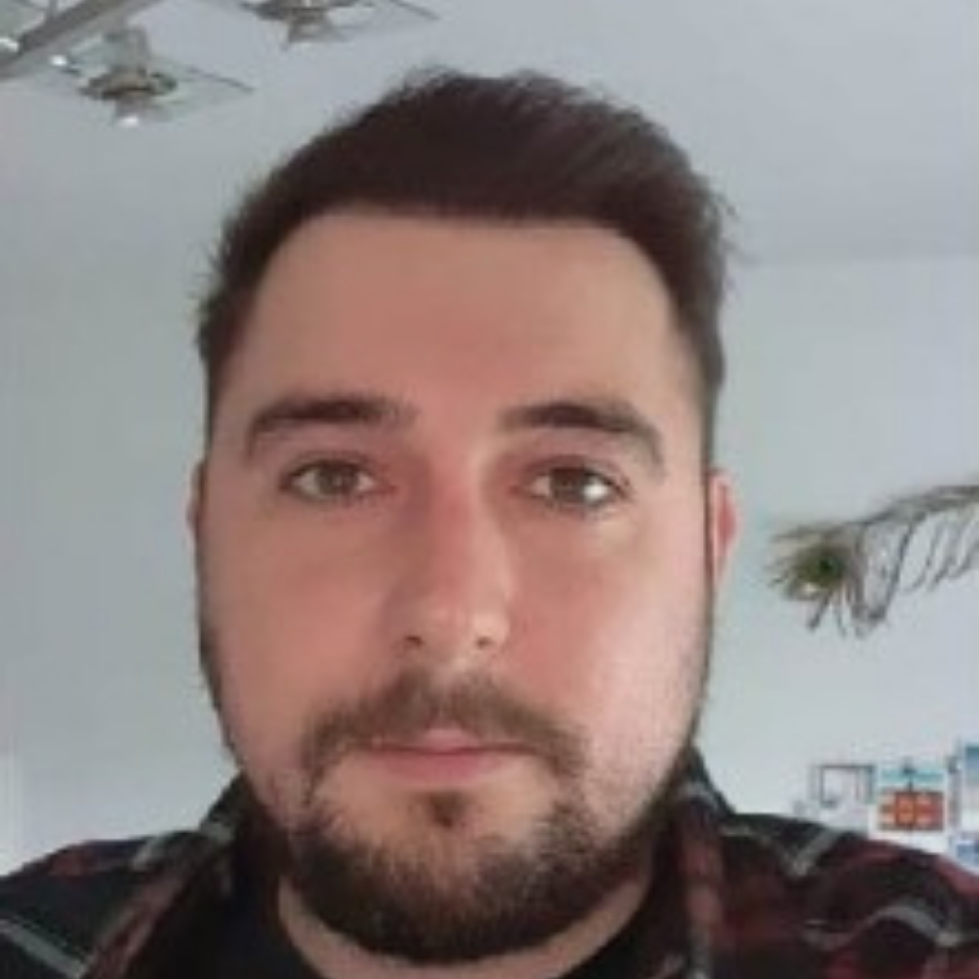 Hair Transplant After